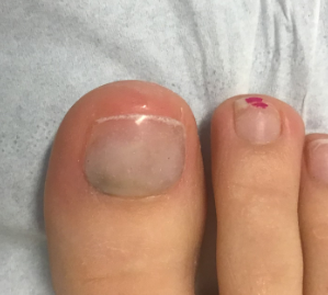 The Long Fake Nail Trend Has Now Extended To Feet